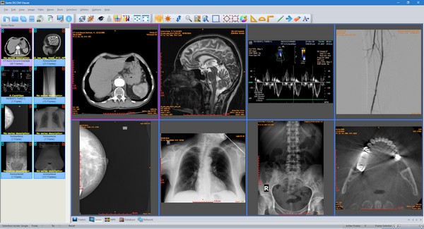 Sante DICOM Viewer(医疗办公软件)v11.8.8官方版