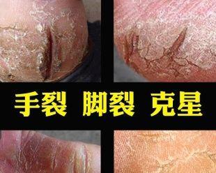 以奕康最强出装攻略(打造无敌奕康,装备从不手软)